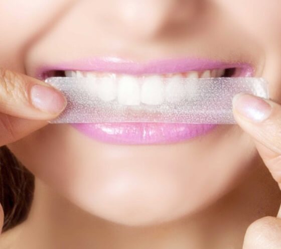 About Dental Whitening Strips