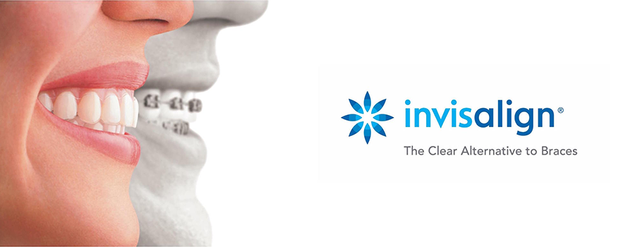 Invisaline Invisible Braces - Crossings Dental