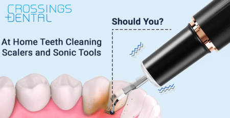 At home teeth cleaning tools