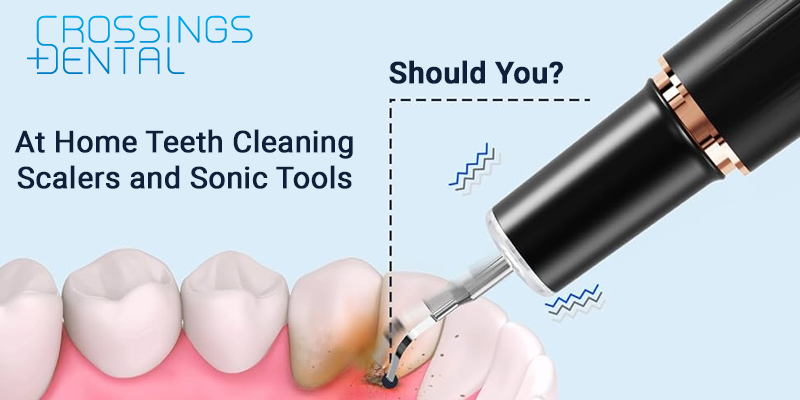 At home teeth cleaning tools