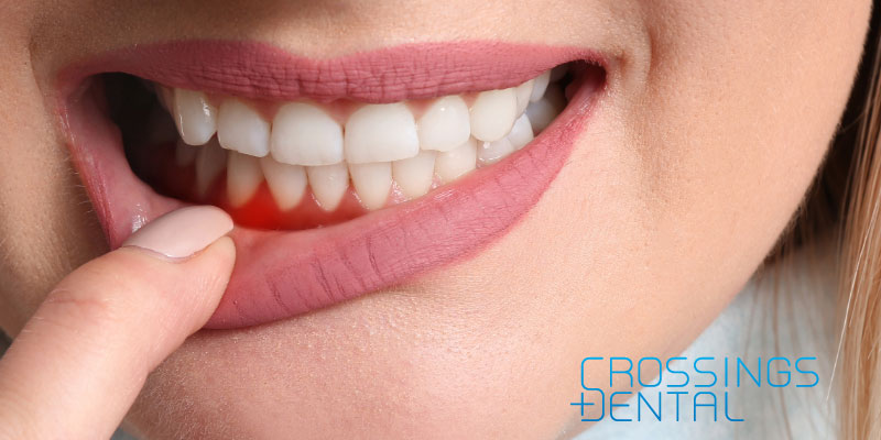 Correcting Gum Disease